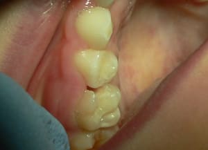 P1030612 yw0kbp - Eugenol