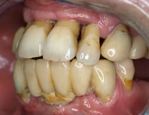 P5126237   copie id8tw2 - Eugenol