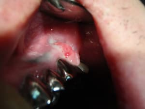 P7070003 gp5ipx - Eugenol