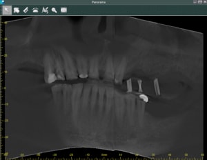Pano scan fsf8zh - Eugenol