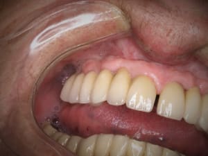 Pb086831  2  hpltdx - Eugenol