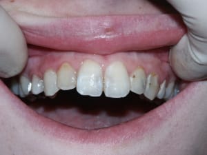 Pict0333 vyt03u - Eugenol