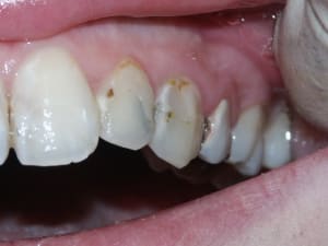 Pict0335 mu9n0t - Eugenol