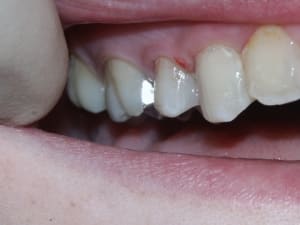 Pict0337 whh28f - Eugenol