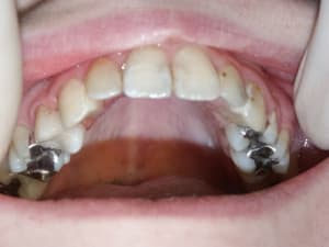 Pict0343 owno6d - Eugenol