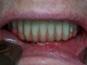 Positdental 14 08 19 076 rqww6y - Eugenol