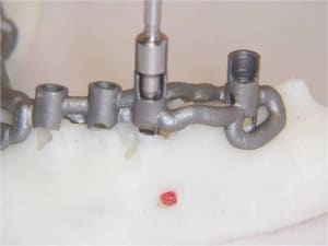 Positdental 8 zfzsgf - Eugenol