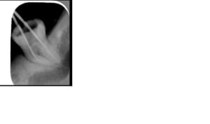 Pac 13 - Eugenol