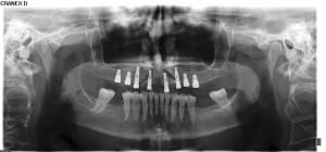 Pan post op qyqumc - Eugenol