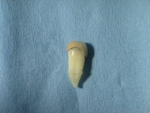 Photo34 002 hnohpr - Eugenol