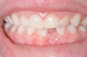 Photo 001 wp0mef - Eugenol