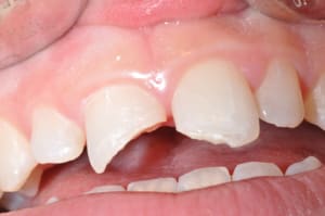 Photo 012 rfllmi - Eugenol
