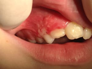 Photo 05 09 2014 16 27 17 t8zrnp - Eugenol