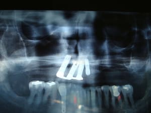 Photo 668 j72nw1 - Eugenol