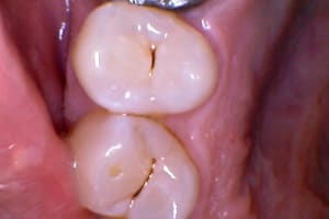 Photo du 14 11 2013   20 - Eugenol