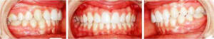 Picture6 wjkiml - Eugenol