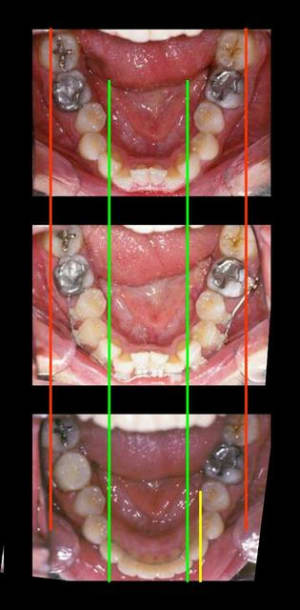 Picture a wcy0sm - Eugenol