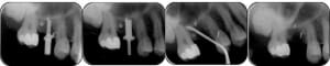 Planche per op ylrrkf - Eugenol