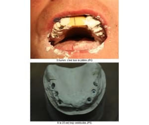 Planche contact 003 vmpcbh - Eugenol
