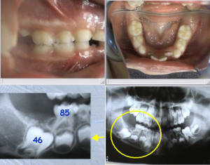Probleme 46 e7gttd - Eugenol