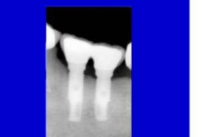 Projet2 isxzkr - Eugenol