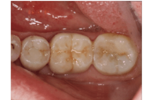 Projetin pro 2 p47909 - Eugenol