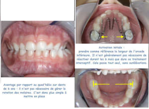 Quad2 jismyr - Eugenol