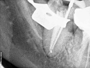 R33 wv7wy5 - Eugenol