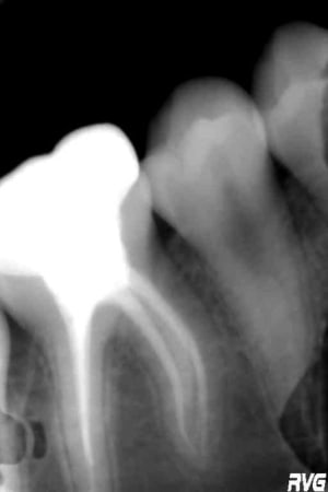 R5 i7bjfk - Eugenol
