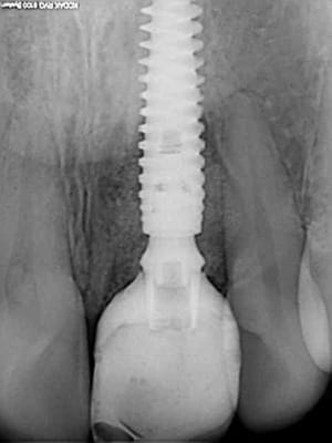 R6 ivxpui - Eugenol
