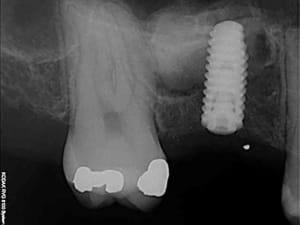 R6 lptmum - Eugenol