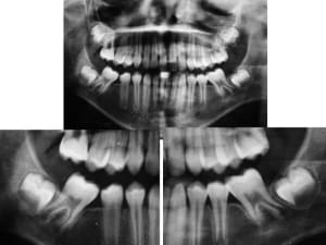 Radios j2kpzi - Eugenol