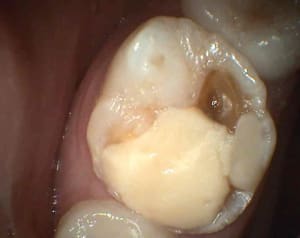 S10 lgqksm - Eugenol