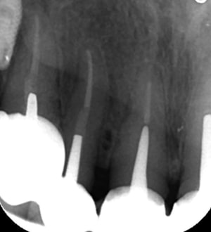 Screenshot111 cn23nd - Eugenol