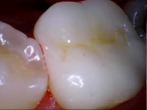 Stillcap0031 xafll3 - Eugenol