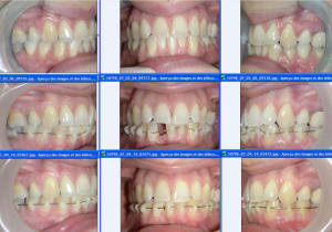 Strip4 gzvhsy - Eugenol