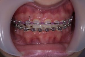 Sub cso8hj - Eugenol