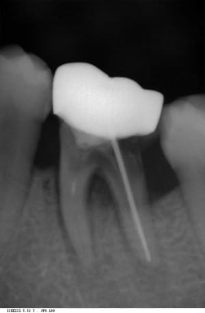 Supertenon aa6qkb - Eugenol