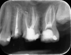 Tr3 pgje6z - Eugenol