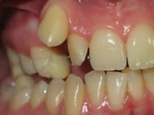 Temp a pgqbud - Eugenol