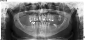 X2274102 pano  aovryi - Eugenol