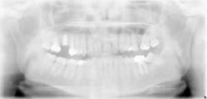 Xxx2 es09zj - Eugenol