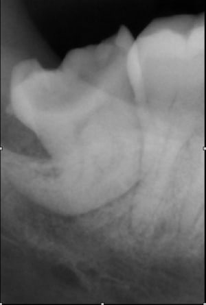 Xray48 ik3maq - Eugenol