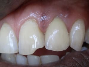 Zoom cas terminé   copie sw5fii - Eugenol