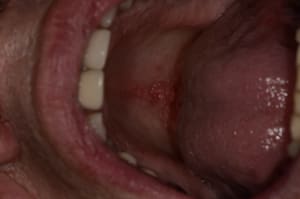  dsc1685 grwsxg - Eugenol