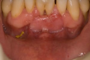  mg 0081 sfprzd - Eugenol