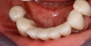  mg 1948 ey7kzp - Eugenol