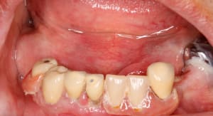  mg 2122 tbwlqq - Eugenol