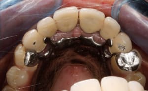  mg 2182 sgtxds - Eugenol