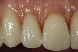  mg 2682 ejnalu - Eugenol